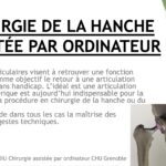CHIRURGIE HANCHE ASSISTÉE PAR ORDINATEUR